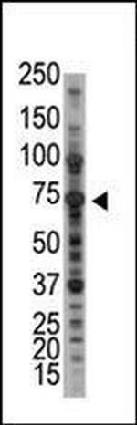 PIAS1 Antibody in Western Blot (WB)