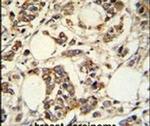 PIGM Antibody in Immunohistochemistry (IHC)