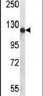 PIGN Antibody in Western Blot (WB)