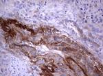 PIK3C2A Antibody in Immunohistochemistry (Paraffin) (IHC (P))