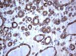 PIK3C2A Antibody in Immunohistochemistry (Paraffin) (IHC (P))