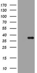 PIK3C2A Antibody in Western Blot (WB)