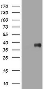 PIK3C2A Antibody in Western Blot (WB)