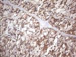 PIK3CA Antibody in Immunohistochemistry (Paraffin) (IHC (P))