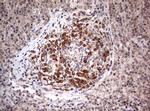 PIK3CA Antibody in Immunohistochemistry (Paraffin) (IHC (P))