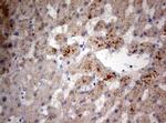 PIK3CA Antibody in Immunohistochemistry (Paraffin) (IHC (P))