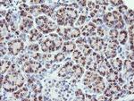 PIK3CG Antibody in Immunohistochemistry (Paraffin) (IHC (P))