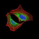 PI3K p85 alpha Antibody in Immunocytochemistry (ICC/IF)