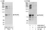 PIK3R2 Antibody in Western Blot (WB)