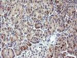 PIK3R5 Antibody in Immunohistochemistry (Paraffin) (IHC (P))