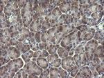 PIK3R5 Antibody in Immunohistochemistry (Paraffin) (IHC (P))