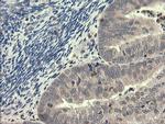 PIK3R5 Antibody in Immunohistochemistry (Paraffin) (IHC (P))