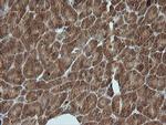 PIK3R5 Antibody in Immunohistochemistry (Paraffin) (IHC (P))