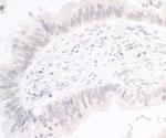 PIMT Antibody in Immunohistochemistry (IHC)