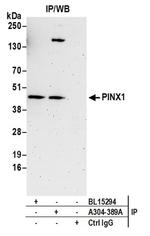 PINX1 Antibody in Western Blot (WB)