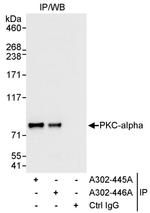 PKC-alpha Antibody in Immunoprecipitation (IP)