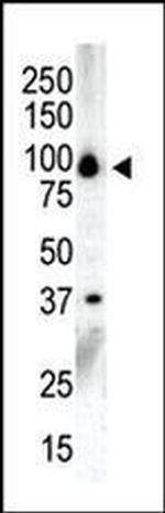 PRKD3 Antibody in Western Blot (WB)