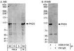 PKD3 Antibody in Western Blot (WB)