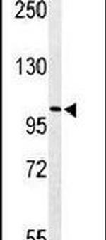 PLEKHH2 Antibody in Western Blot (WB)