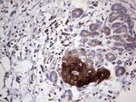 PKM2 Antibody in Immunohistochemistry (Paraffin) (IHC (P))