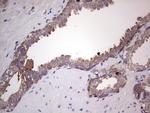 PKM2 Antibody in Immunohistochemistry (Paraffin) (IHC (P))