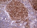 PKM2 Antibody in Immunohistochemistry (Paraffin) (IHC (P))