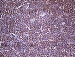 PKM2 Antibody in Immunohistochemistry (Paraffin) (IHC (P))