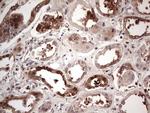 PKM2 Antibody in Immunohistochemistry (Paraffin) (IHC (P))