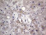 PKM2 Antibody in Immunohistochemistry (Paraffin) (IHC (P))