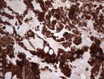 PKM2 Antibody in Immunohistochemistry (Paraffin) (IHC (P))