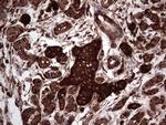 PKM2 Antibody in Immunohistochemistry (Paraffin) (IHC (P))