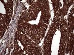 PKM2 Antibody in Immunohistochemistry (Paraffin) (IHC (P))