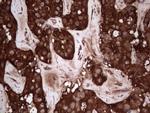 PKM2 Antibody in Immunohistochemistry (Paraffin) (IHC (P))