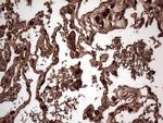 PKM2 Antibody in Immunohistochemistry (Paraffin) (IHC (P))