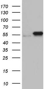 PKM2 Antibody in Western Blot (WB)