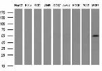 PKM2 Antibody in Western Blot (WB)