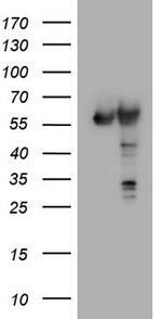 PKM2 Antibody in Western Blot (WB)