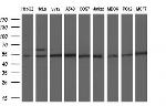 PKMYT1 Antibody in Western Blot (WB)