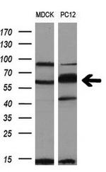 PKMYT1 Antibody in Western Blot (WB)