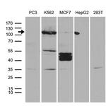 PKN3 Antibody in Western Blot (WB)