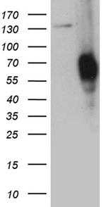 PLA2G3 Antibody in Western Blot (WB)