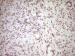 PLAT Antibody in Immunohistochemistry (Paraffin) (IHC (P))