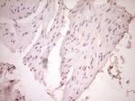 PLAT Antibody in Immunohistochemistry (Paraffin) (IHC (P))