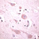 PLCB1 Antibody in Immunohistochemistry (IHC)