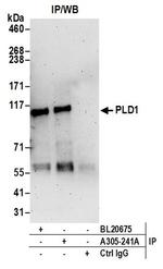 PLD1/Phospholipase D1 Antibody in Immunoprecipitation (IP)