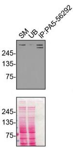 Plectin Antibody in Immunoprecipitation (IP)