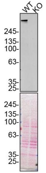 Plectin Antibody in Western Blot (WB)