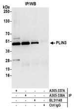 PLIN3 Antibody in Immunoprecipitation (IP)