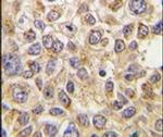 PMAT Antibody in Immunohistochemistry (IHC)