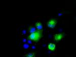 PMEL Antibody in Immunocytochemistry (ICC/IF)